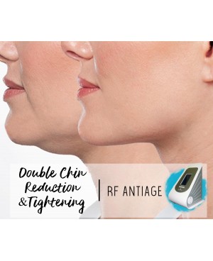 Treatment Voucher - Double Chin Reduction & Tightening with RF Antiage Transdermotherapy