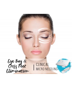 Treatment Voucher - Eye Bag & Cross Feet Elimination with Clinical Micro Needling
