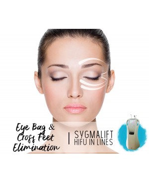 Treatment Voucher - Eye Bag & Cross Feet Elimination with SygmaLift