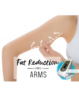 Treatment Voucher - Fat Reduction (Arms) with RF Antiage Transdermotherapy