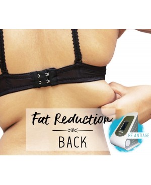 Treatment Voucher - Fat Reduction (Back) with RF Antiage Transdermotherapy