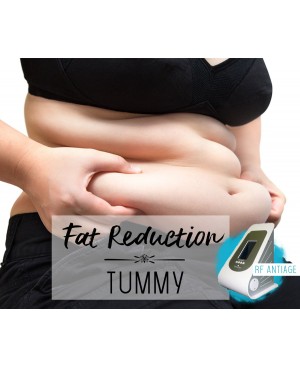 Treatment Voucher - Fat Reduction (Tummy) with RF Antiage Transdermotherapy