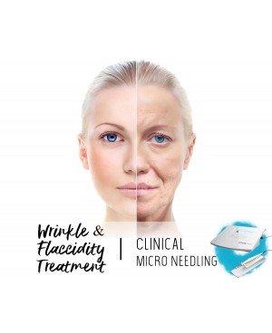 Treatment Voucher - Wrinkles & Flaccidity Treatment with Clinical Micro Needling