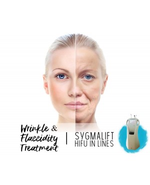 Treatment Voucher - Forehead Wrinkles Treatment with SygmaLift