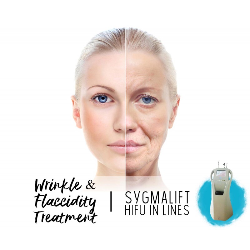 Treatment Voucher - Forehead Wrinkles Treatment with SygmaLift
